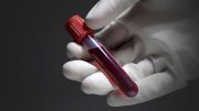 How long a person can live can be identified through blood test