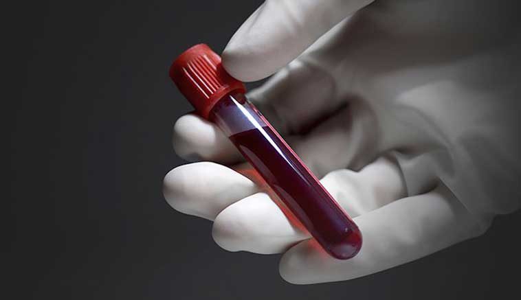 How long a person can live can be identified through blood test